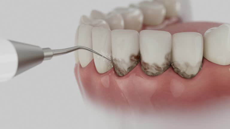 Trusted Emergency Dentist service in Muskogee, OK - Dentist Open Now
